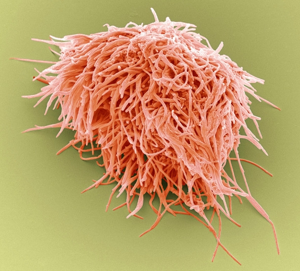 你看过这样的吗？显微镜下的口腔：这么恐怖