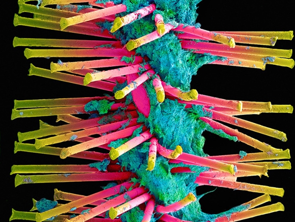 你看过这样的吗？显微镜下的口腔：这么恐怖