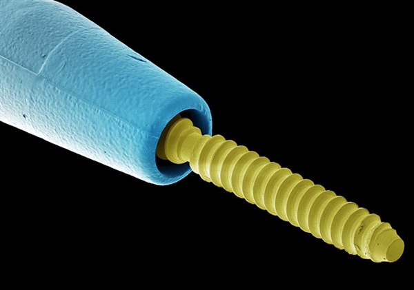 你看过这样的吗？显微镜下的口腔：这么恐怖