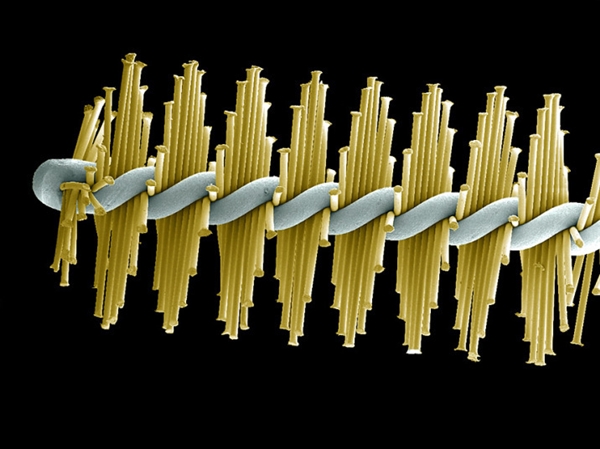 你看过这样的吗？显微镜下的口腔：这么恐怖