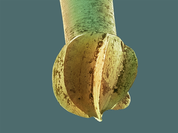 你看过这样的吗？显微镜下的口腔：这么恐怖