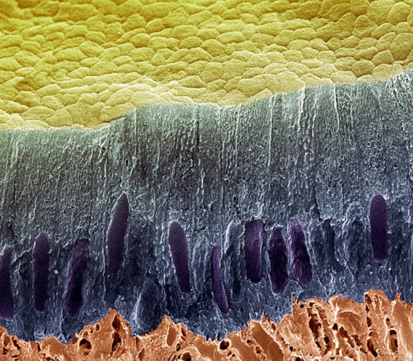 你看过这样的吗？显微镜下的口腔：这么恐怖