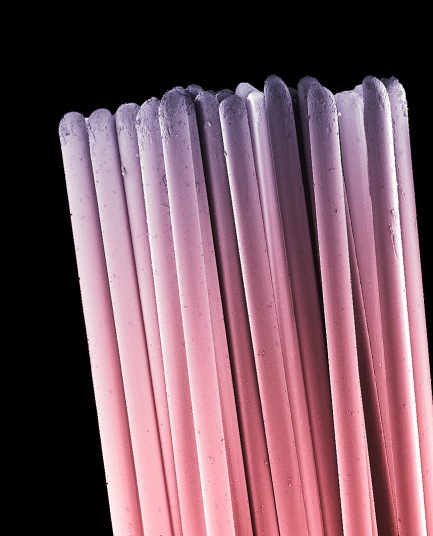 你看过这样的吗？显微镜下的口腔：这么恐怖